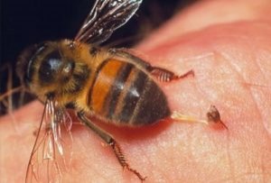 Xử trí khi bị ong đốt