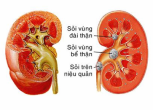 phong benh soi than