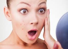Mụn trứng cá sẽ để lại nhiều vết sẹo